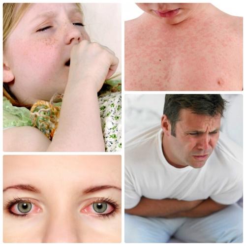allergiaoireet