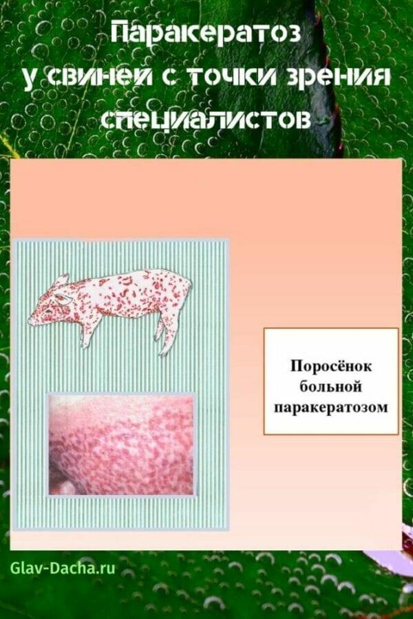 parakeratoosi sioilla