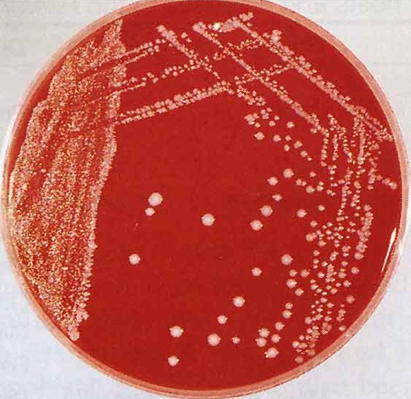 patogeenibakteeri pasteurella